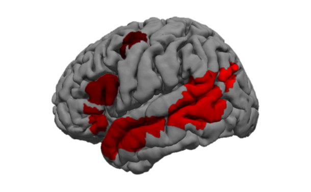 The brain's language network