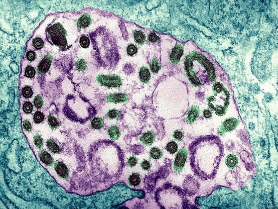 Marburg virus image