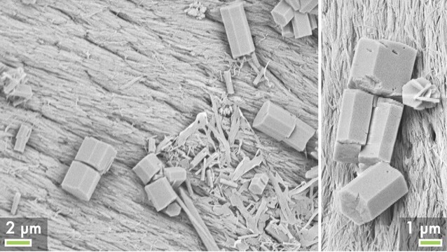 Scanning electron microscopy (SEM) images of strange unidentified crystals formed on a piece of bone that was exposed to tryptic soy broth. The crystals are hexagonal in shape. #crystals #mystery #biology #science #electronmicroscopy