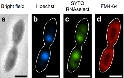 Confocal-laser microscopy showing the localization of DNA and RNA within the intracytoplasmic membrane structure. DNA, RNA, and membrane lipids were stain­ed by Hoechst (blue), SYTO RNAselect (green) and FM4-64 (red), respectively. Outlines of the cell from a are included in all panels. a Phase contrast image. b–d Confocal-laser images. Scale bars, 1 μm. [Source: https://pubmed.ncbi.nlm.nih.gov/33318506/]