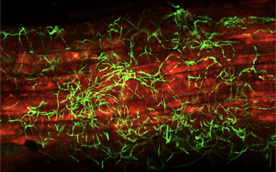 A. thaliana root (red) colonized with an endophytic Streptomyces strain expressing a green fluorescent protein. Source: https://doi.org/10.1128/AEM.01053-20