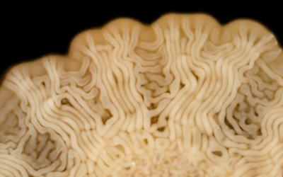 C. matruchotii colony. Courtesy of © Scott Chi­mi­les­ki